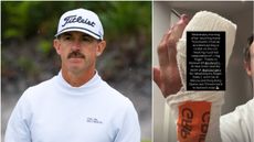 Wade Ormsby pictured in golfing action an an Instagram post of his hand after finger surgery