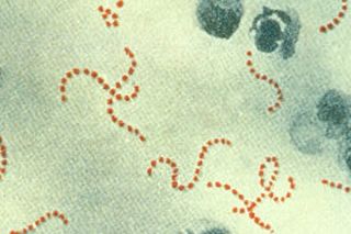 Streptococcus pyogenes 