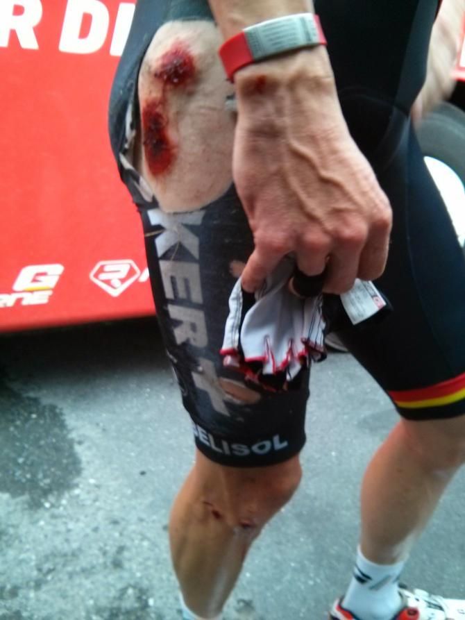 Marcel Sieberg's right hip after stage 6