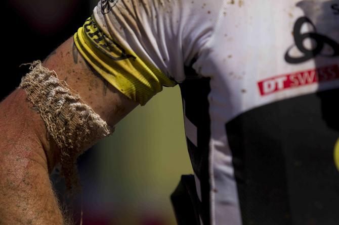 The course took its toll today - Florian Vogel of Scott-Swisspower shows some war wounds