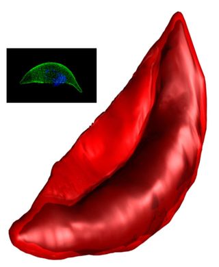 The malaria parasite morphs from its spherical shape to its sexual-stage banana shape, shown here in both an X-ray image and one using 3D microscopy (inset). 