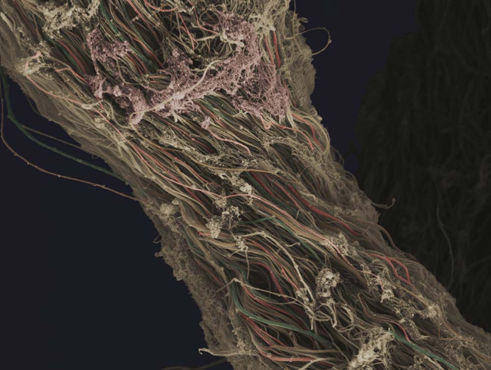 connective tissue from the knee