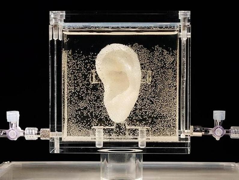 Artist creates replica of Van Gogh&amp;#039;s ear using living cells from relative