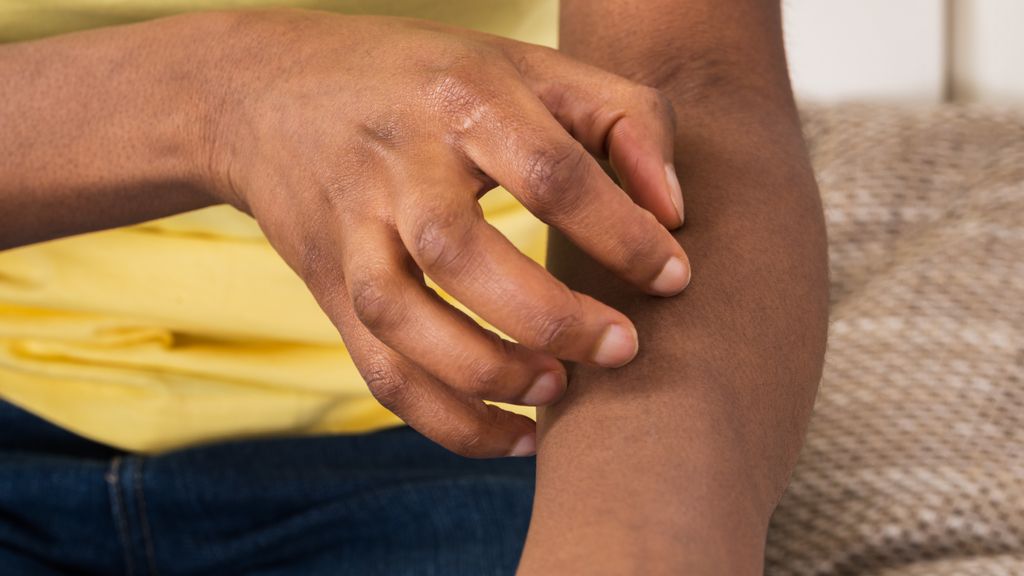 close-up of woman&#039;s hand scratching an itch on her arm