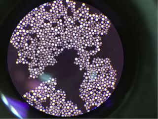 Cryptococcus neoformans