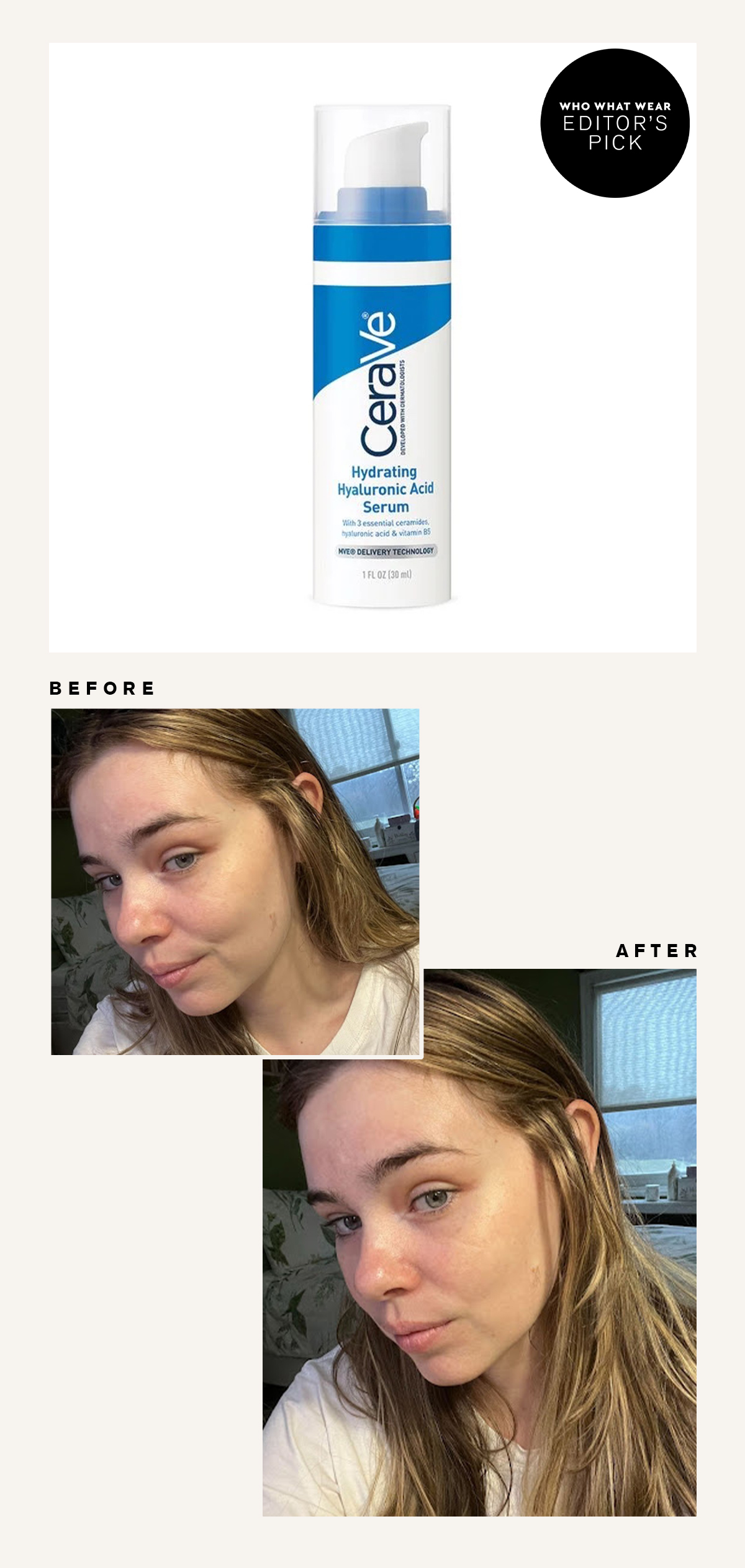 Cerave Hyaluronic Acid: Before and After Picture