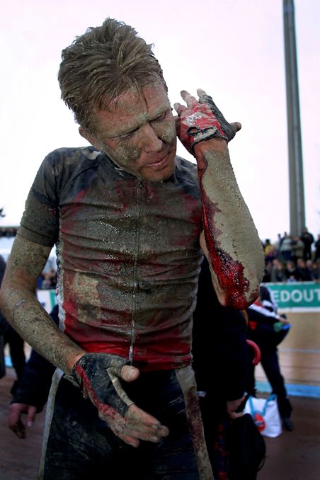 Rolf Sorensen scans his injuries after the finish of Paris-Roubaix in 2001