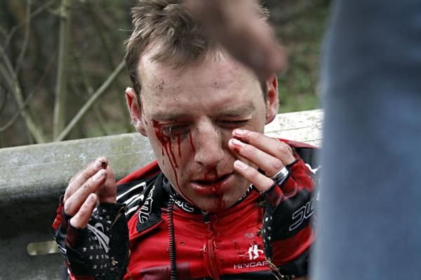 Karsten Kroon (BMC) suffered facial injuries in a crash.