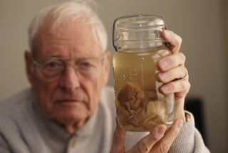 Thomas Stoltz Harvey holds up a jar containing a piece of Albert Einstein's brain in 1994. Harvey oversaw Einstein's autopsy in 1955, and kept much of the physicist's brain in his personal posession for more than 40 years.