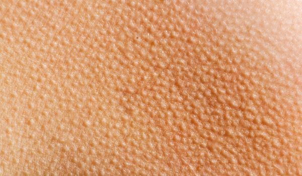 what-causes-goose-bumps-live-science