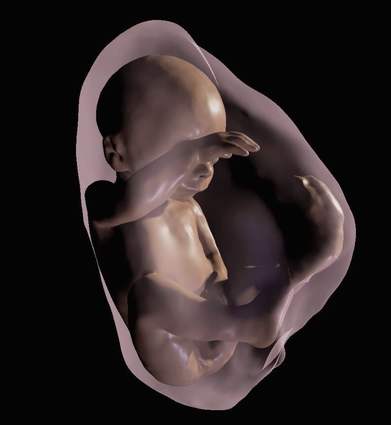 This image shows a 3-D virtual model of a fetus at 26 weeks.