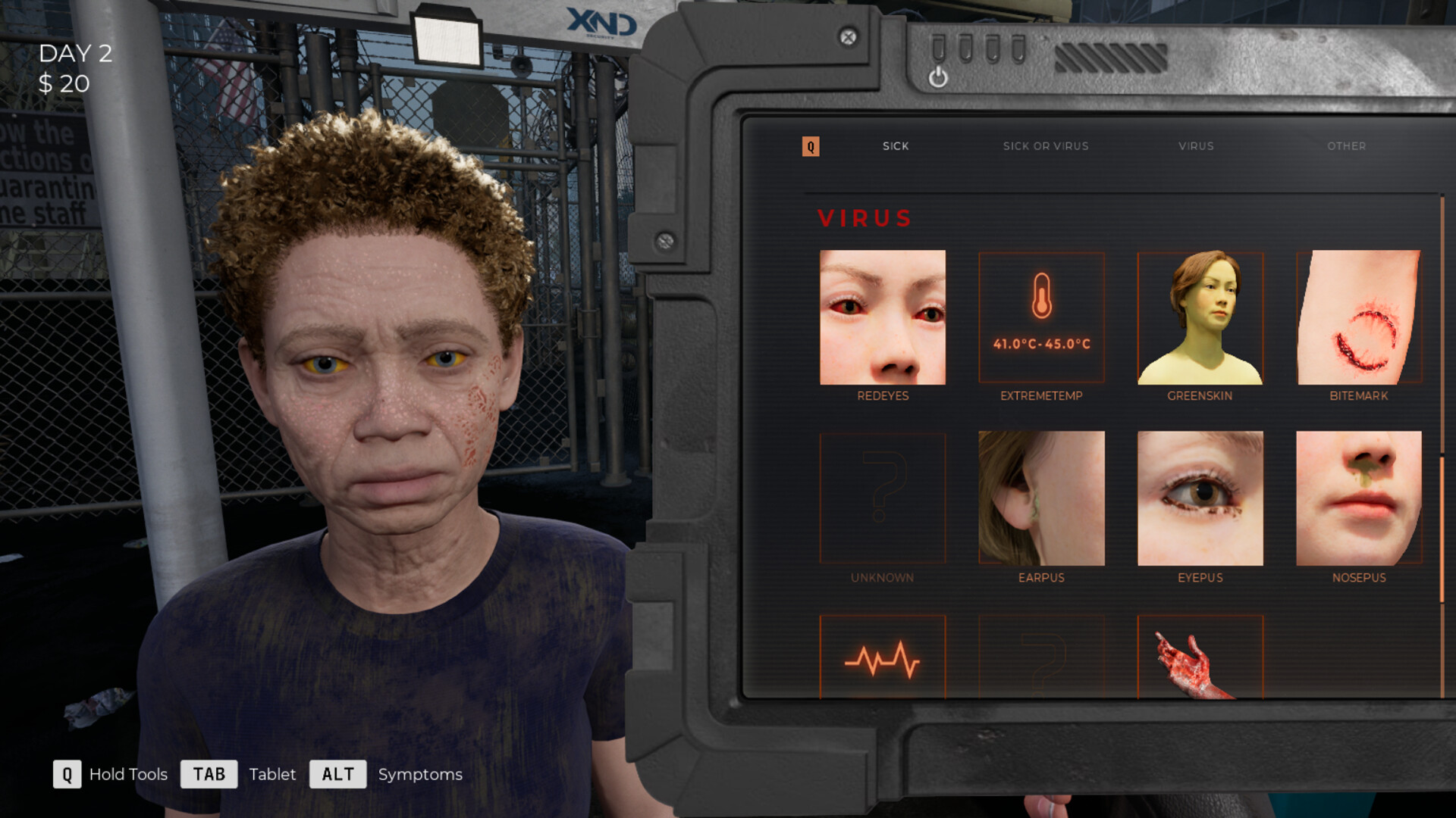 A person being inspected for zombie virus