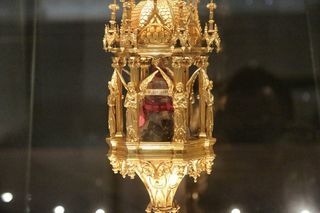 Preserved brain pieces of St. John Bosco are kept at the basilica of Castelnuovo, near Turin, Italy.