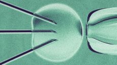 Photo collage of an in vitro fertilisation, with three needles going into the cell