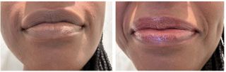 a before and after image of Deena Campbell using manuka health's lip blam