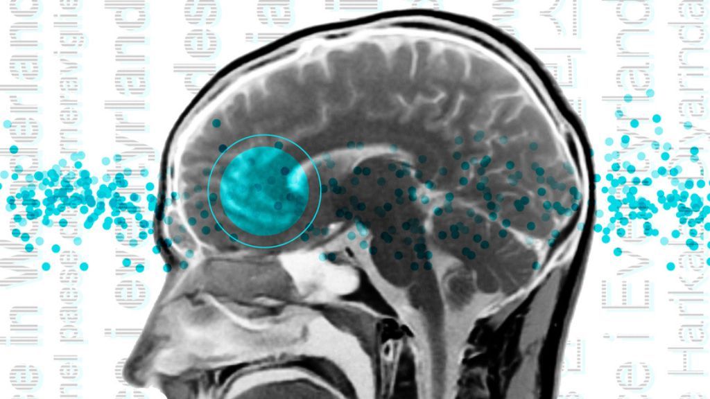 brain scan with a region of the left hemisphere highlighted in blue; behind the scan, sentences pulled from Alice in Wonderland can be seen running from the bottom of the image to the top