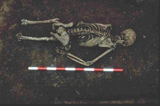 The 1,500-year-old skeleton was found face down with the right arm bent at an unusual angle. Study researchers say that he may have been tied up when he died. His lower body was destroyed by modern-day development.