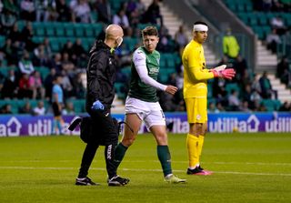 Hibernian v Rijeka – UEFA Europa Conference League – Third Qualifying Round – First Leg – Easter Road Stadium