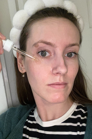 woman applies eye serum to her face.