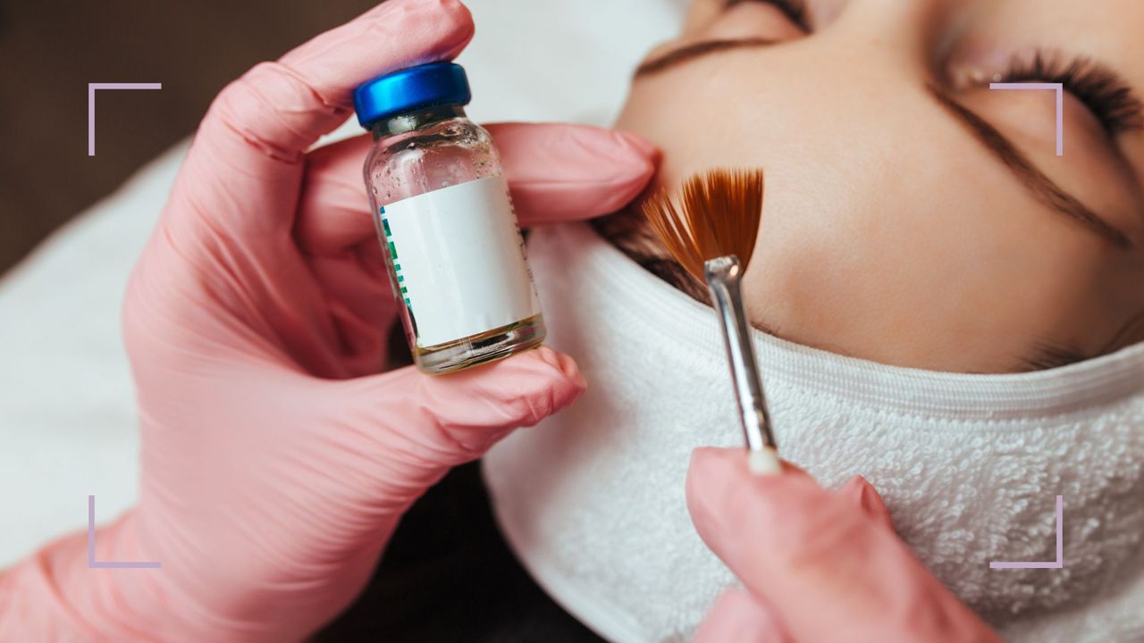 A woman having the VI Peel applied by an aesthetician&#039;s gloved hand