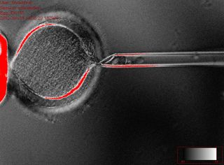 Creating a cloned human embryo