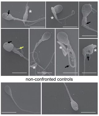 常见寄生虫斩首人类精子 A figure of a scientific paper. On the top, various microscope images of damaged sperm. On the bottom, microscope images of healthy sperm.