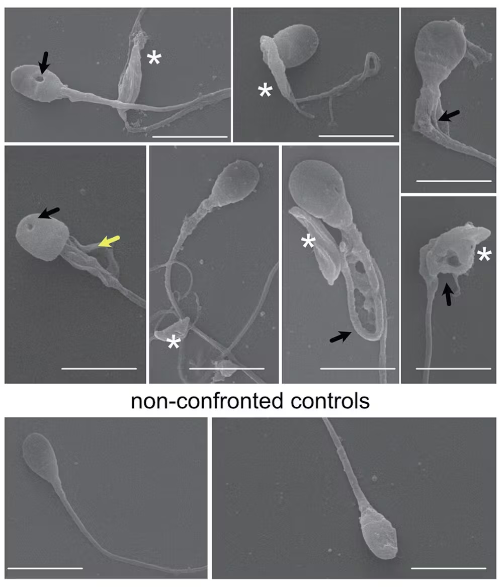 A figure of a scientific paper. On the top, various microscope images of damaged sperm. On the bottom, microscope images of healthy sperm.