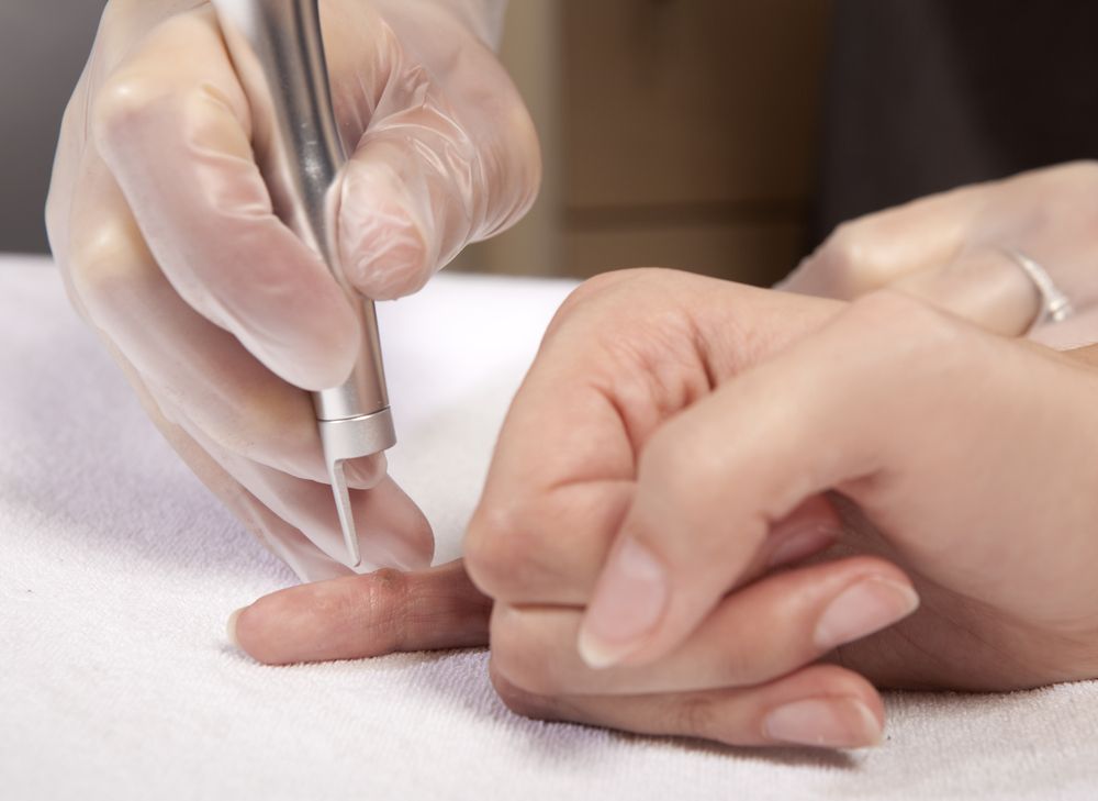 Warts on hands best treatment. Warts on hands and feet treatment