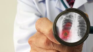 A representation of a doctor looking for symptoms of the new Wuhan coronovirus in a patient.