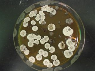 A culture of the Streptomyces bacteria. This bacteria inspired a potential new type of rocket fuel.