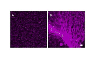 blood clotting, artificial platelets, wound healing