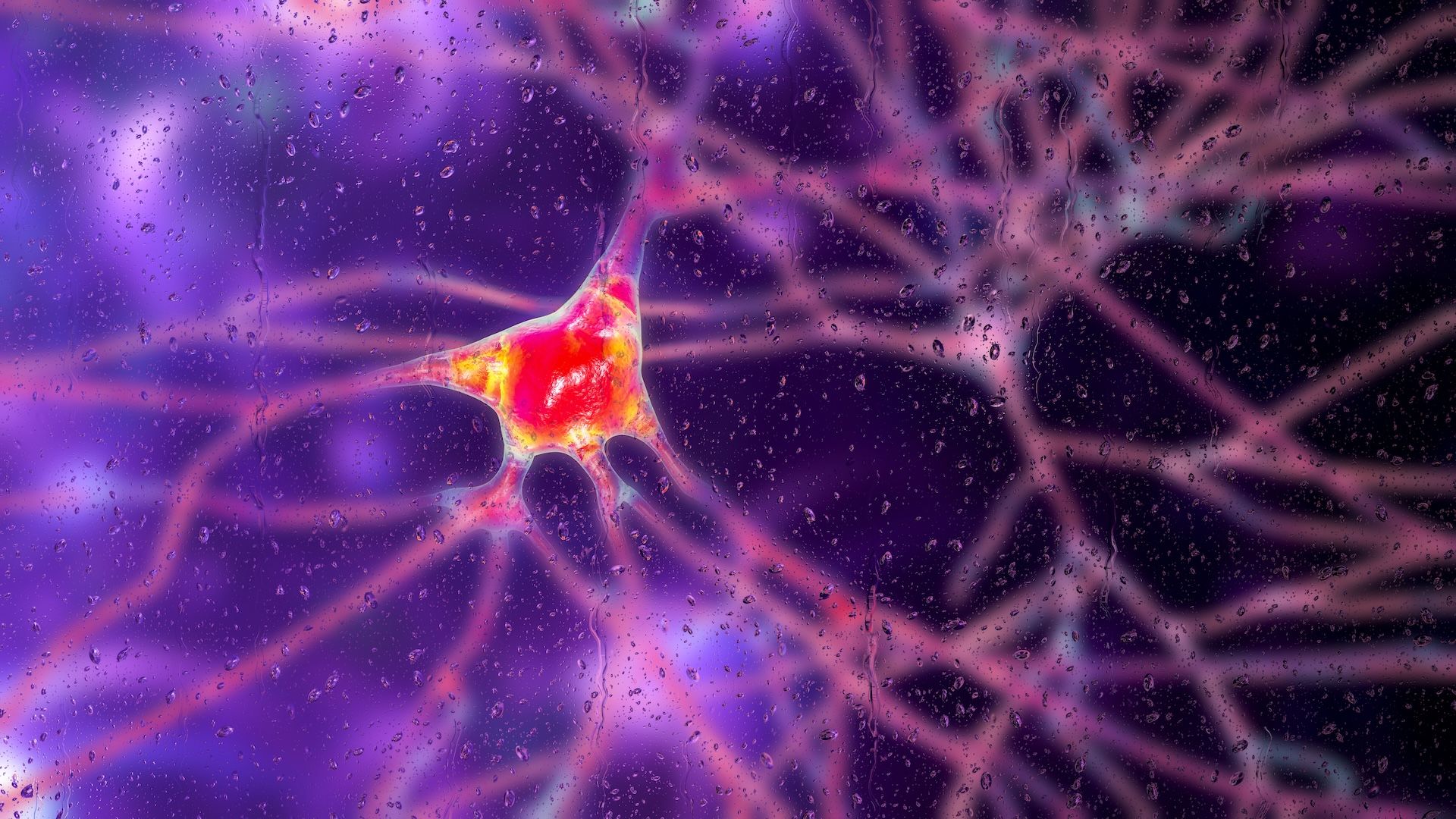 Gene therapy slows Huntington's disease progression by 75%