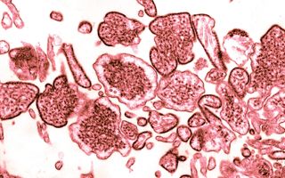 The Nipah virus in a sample of cerebrospinal fluid from an infected patient.