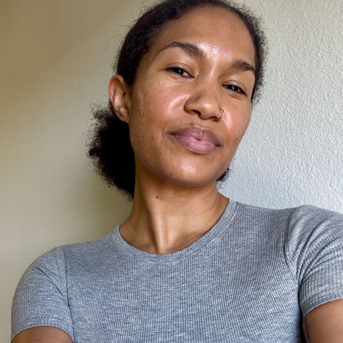 I’ve Tried a Lot of Treatments—This is the Only One That’s Truly Transformed My Damaged, Acne- image