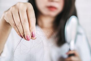 Woman suffering with postpartum hair loss