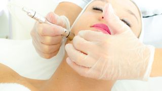 A woman receiving microdermabrasion from an expert