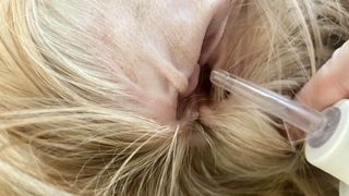 Dog ear cleaning solution being applied to the ear canal of a dog