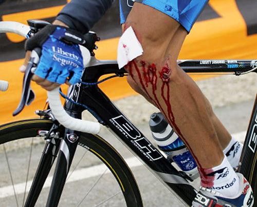 Roberto Heras' leg has seen better days.