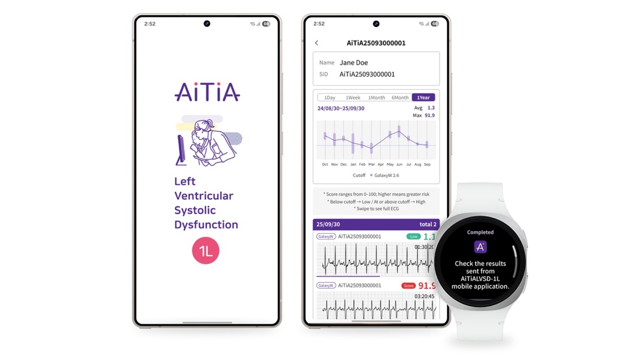 A screenshot of a health app showing LVSD analysis and detection
