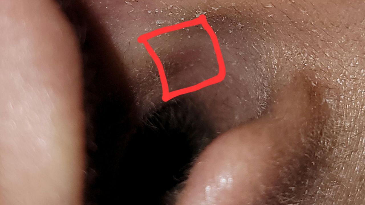Images of irritation in TheBlack_Swordsman from Samsung Galaxy Buds2 Pro