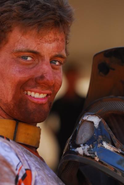 Josh Button shows off the damage done to his helmet in the crash that ended his run.