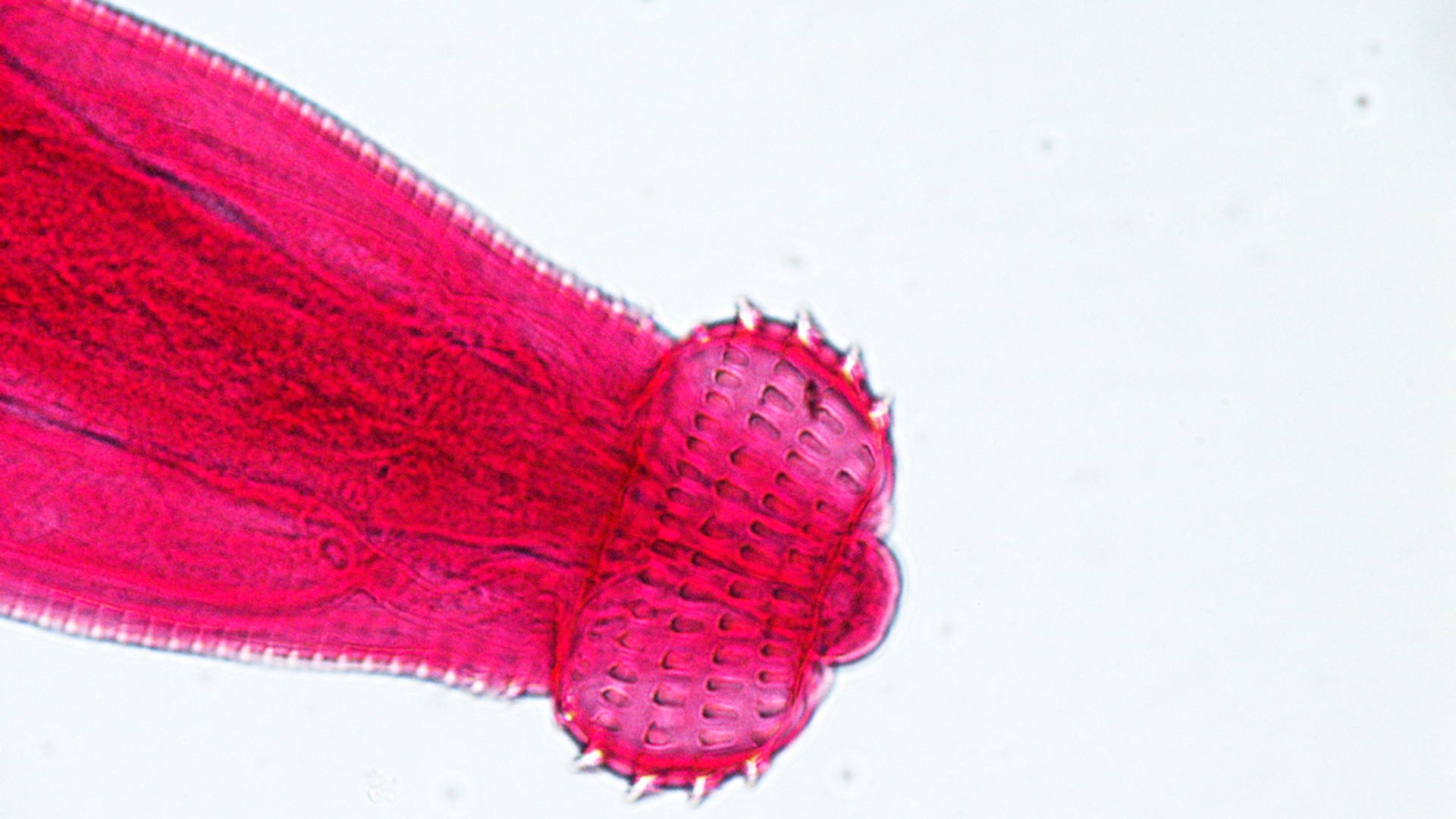 A microscopic photo of a worm in the genus  Gnathostoma