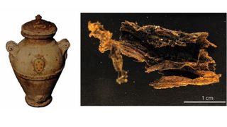 A jar (left) and and yellowish human tissue against a black background (right).