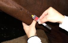 Liver-biopsy_188644691_273733111.jpg