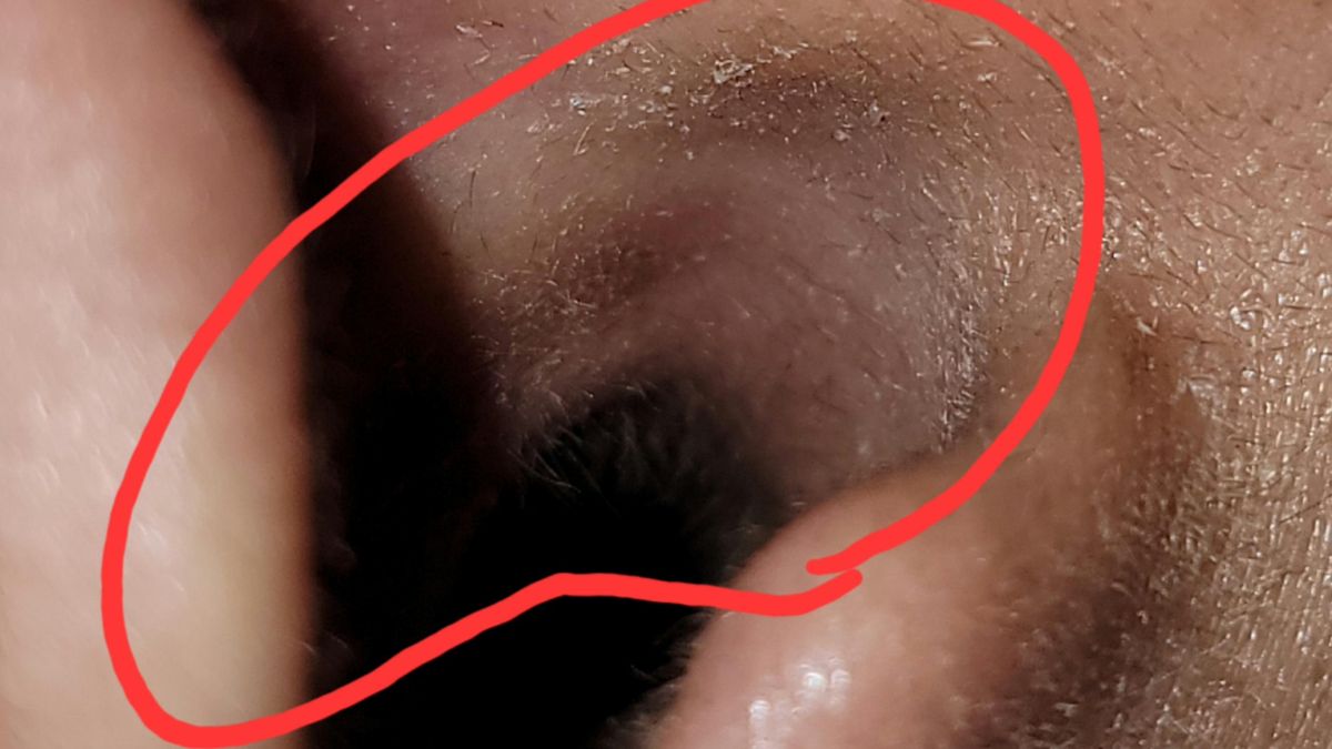 Images of irritation in TheBlack_Swordsman from Samsung Galaxy Buds2 Pro