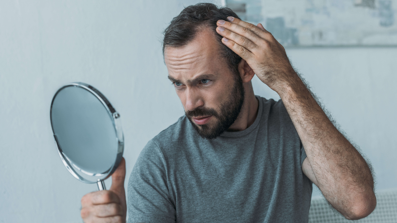 man looking at hair loss