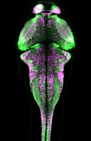 This image reveals the brain of a zebrafish while it was swimming, with the active neurons as magenta.