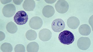 a microscope image of malaria parasites infecting red blood cells