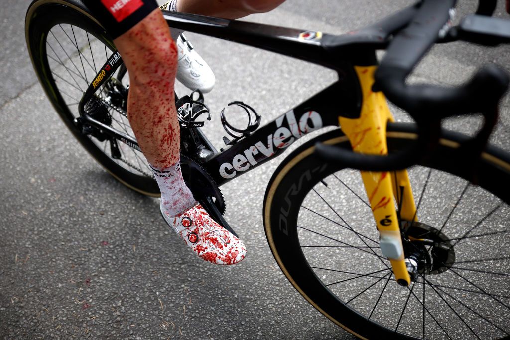 PONTIVY FRANCE JUNE 28 Steven Kruijswijk of The Netherlands and Team JumboVisma involved in a crash during the 108th Tour de France 2021 Stage 3 a 1829km stage from Lorient to Pontivy Injury LeTour TDF2021 on June 28 2021 in Pontivy France Photo by Stephane Mahe PoolGetty Images