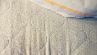 Image shows yellow stains on a mattress that needs replacing completely